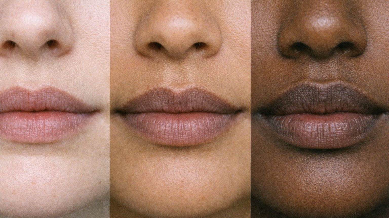 melanotan 2 dose melanotan 2 before or after Eruptive naevi and darkening of preexisting  naevi 24 h after a