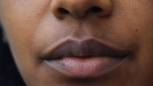 Dark Upper Lip: Causes and How to Fade It