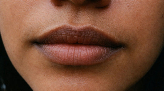 Labios oscuros y manchados: por qué se oscurecen y cómo corregirlos