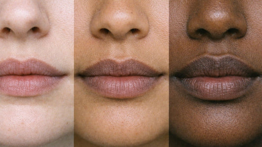 Lip Discoloration: A Complete Guide to Every Type, Cause, and Solution