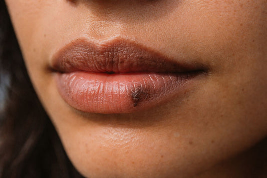 Manchas en los labios: 5 tipos, causas y cómo eliminarlas