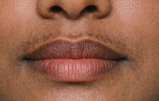 Dark Skin Around the Mouth: Causes and How to Fade It