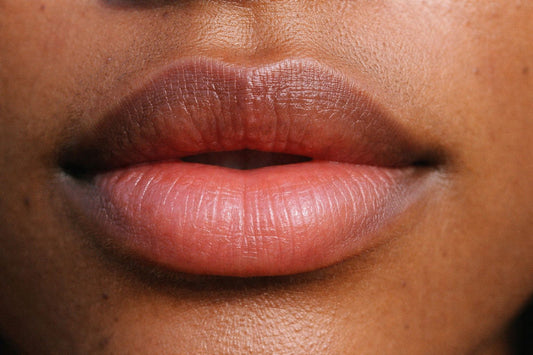Two Toned Lips: Causes and Correction